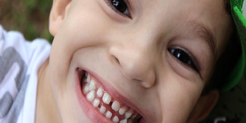 Can A Grey Baby Tooth Turn White Again