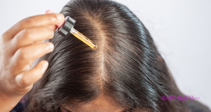 Why Minoxidil Is A Safe And Effective Solution For New Moms